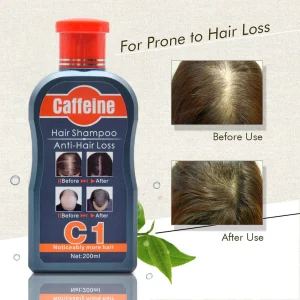 caffeine shampoo | anti hair loss & scalp treatment